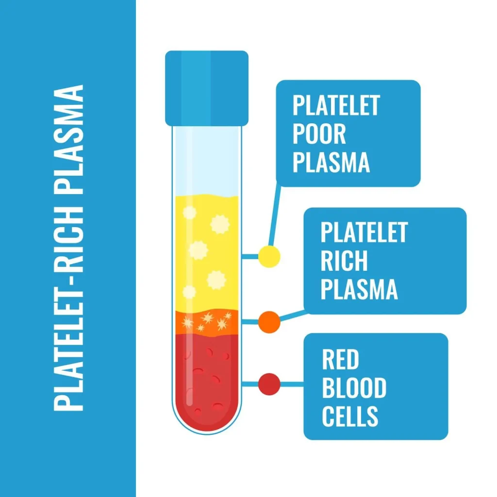 PRP Therapy: Supporting the Body’s Natural Healing Process